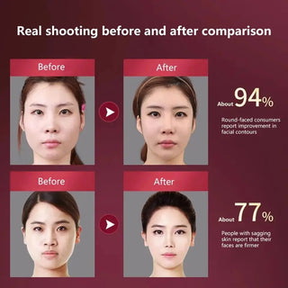 Unlock Radiant Skin: Advanced 12-Gear Electric Facial Lifting Massager for V-Line Slimming and Spa-Like Treatments at Home